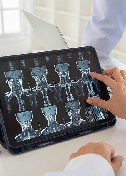 icd 10 spinal fusion status